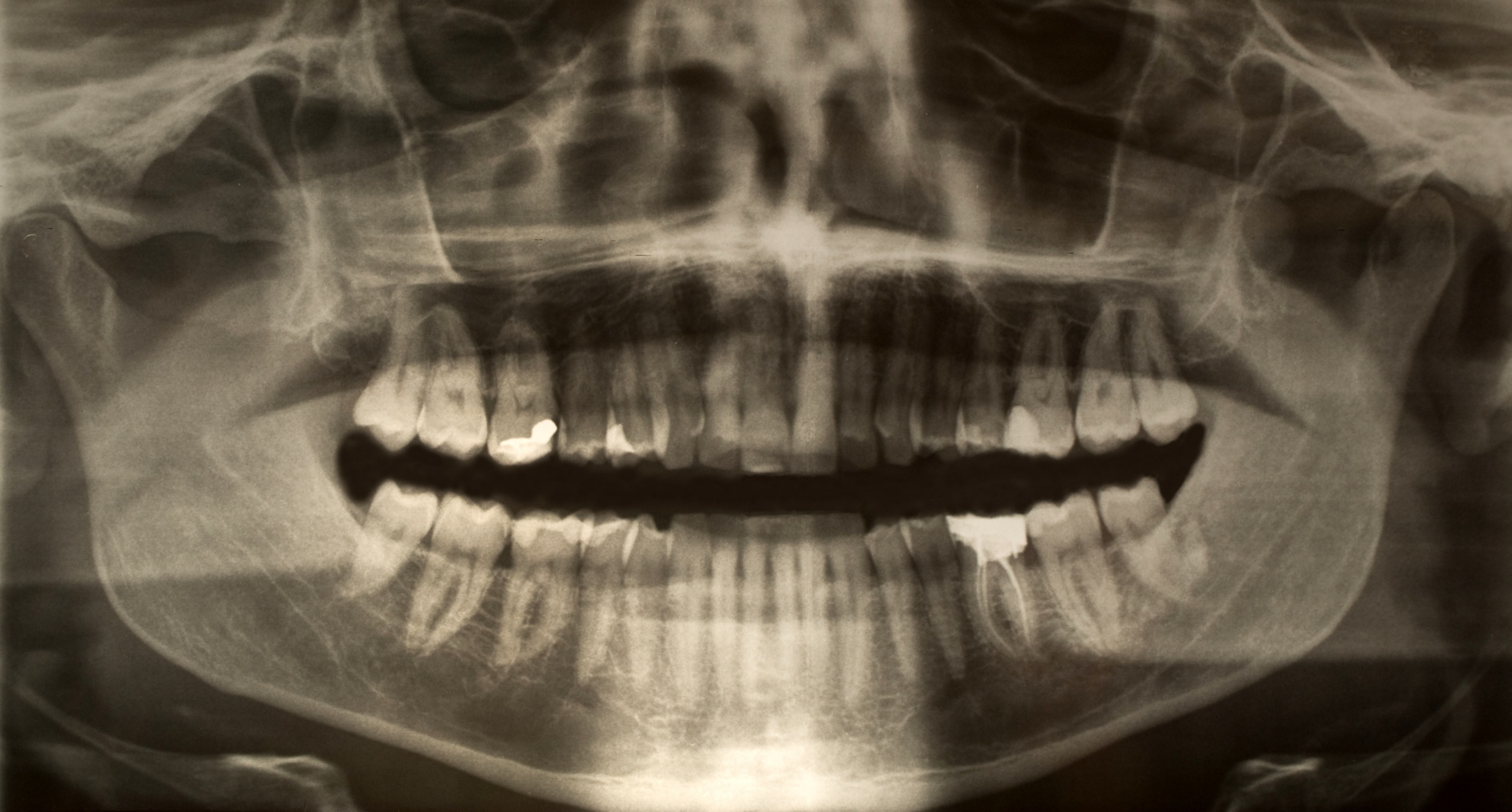 PrimeCare dental trauma x-ray evaluation